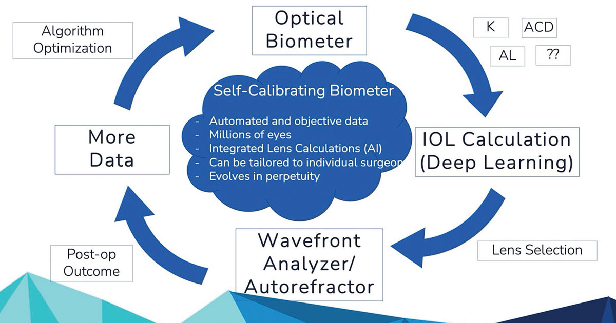 Self-optimizing, self-calibrating ocular biometer will continually use surgical data